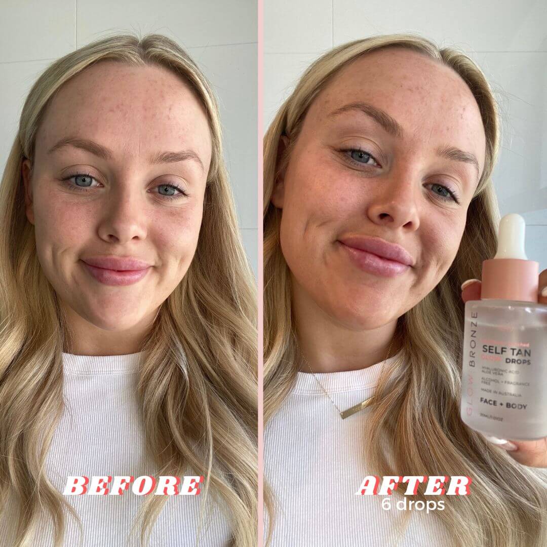 Face Tanning Drops before and after - GlowBronze by GlowDry Australia