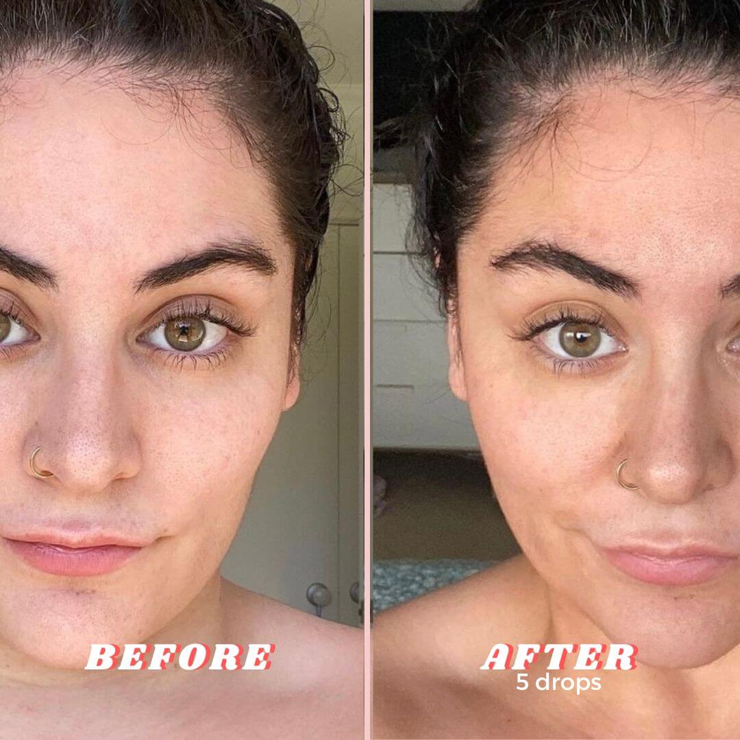 Face Tanning Drops before and after - GlowBronze by GlowDry Australia